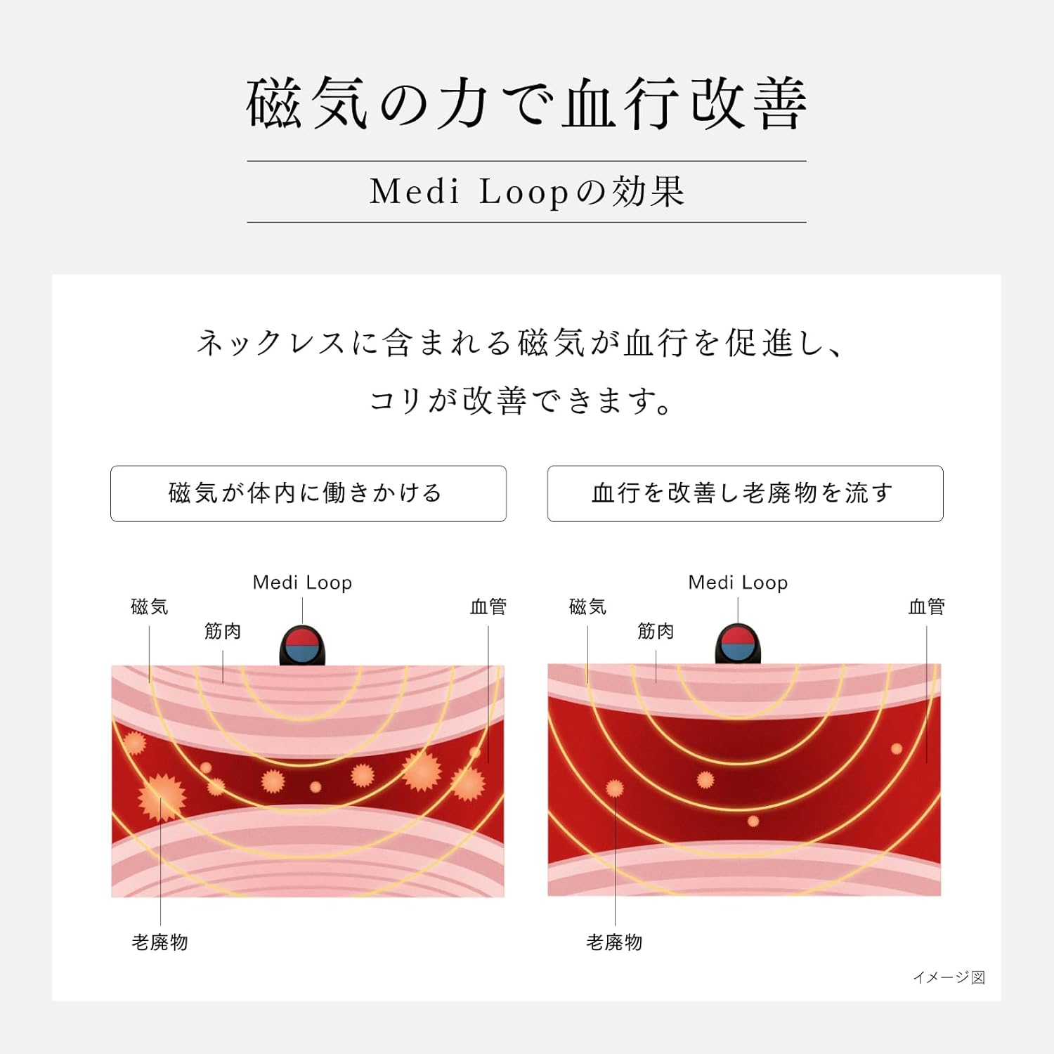 Medi Loop（S） 画像5