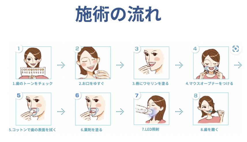 【導入費用無料】セルフホワイトニング(60か月プラン) 画像6